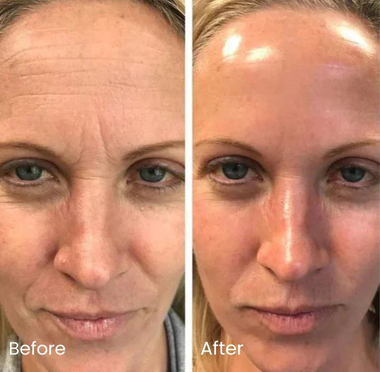 Wrinkles, Dark Spots & Radiant Glow (100 Pads)