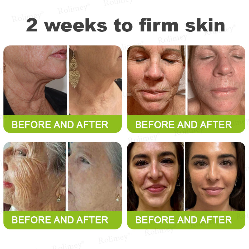 ✔Made and shipped from Canada 💫Rolimey® Botox & Vita-A Retinol Shot Wrinkle-Lift Tightening cream - Last Day Promotion 70% OFF