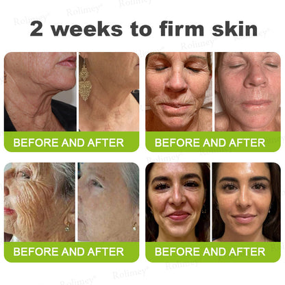🍀Made and shipped from Canada 💫Rolimey® Botox & Vita-A Retinol Shot Wrinkle-Lift Tightening cream - Last Day Promotion 50% OFF