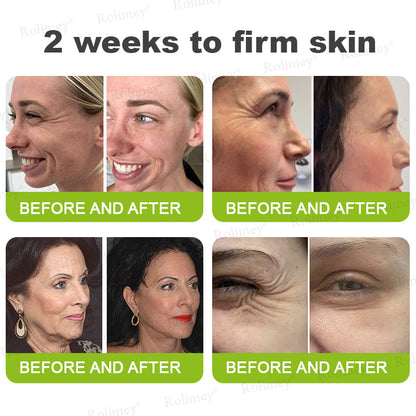✔Made and shipped from Canada 💫Rolimey® Botox & Vita-A Retinol Shot Wrinkle-Lift Tightening cream - Last Day Promotion 70% OFF