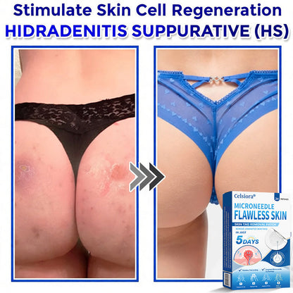🍀🌿Celsiora® 2-in-1 Microneedle & Hydrocolloid Patch | Raised Moles,Acne, Flat Warts & Skin Tags Remover | Improves Wrinkles, Scars & Blemishes | Invisible Pimple Patches for Face & Body | 24 Count