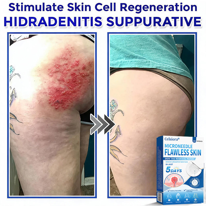 🍀🌿Celsiora® 2-in-1 Microneedle & Hydrocolloid Patch | Raised Moles,Acne, Flat Warts & Skin Tags Remover | Improves Wrinkles, Scars & Blemishes | Invisible Pimple Patches for Face & Body | 24 Count