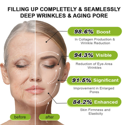 🍀Made and shipped from Canada 💫Rolimey® Botox & Vita-A Retinol Shot Wrinkle-Lift Tightening cream - Last Day Promotion 50% OFF