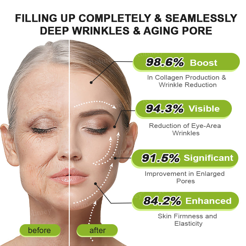 ✔Made and shipped from Canada 💫Rolimey® Botox & Vita-A Retinol Shot Wrinkle-Lift Tightening cream - Last Day Promotion 70% OFF