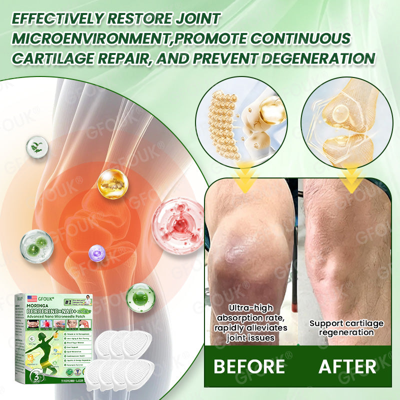 👨‍⚕️👨‍⚕️𝑶𝒇𝒇𝒊𝒄𝒊𝒂𝒍 𝑺𝒕𝒐𝒓𝒆  | 💫💫Evolvion® 𝑴𝒐𝒓𝒊𝒏𝒈𝗮 · 𝗕𝗲𝗿𝗯𝗲𝗿𝙞𝙣𝙚 × 𝙉𝘼𝐃+ 𝟏𝟎-𝐢𝐧-𝟏 𝗔𝗱𝘃𝗮𝗻𝗰𝙚𝙙 𝙉𝙖𝙣𝙤 𝙈𝙞𝙘𝙧𝙤𝙣𝙚𝙚𝐝𝐥𝐞 𝐏𝐚𝐭𝙘(𝐉𝐮𝐬𝐭 𝐨𝐧𝐜𝐞 𝐚 𝐝𝐚𝐲, 𝐯𝐢𝐬𝐢𝐛𝐥𝐞 𝐜𝐡𝐚𝐧𝐠𝐞𝐬 𝐢𝐧 𝟕 𝐝𝐚𝐲𝐬） ✅ 𝐅𝐨𝐫 𝐨𝐛𝐞𝐬𝐢𝐭𝐲, 🅛🅞🅞🅢🅔 🅢🅚🅘🅝,𝐝𝐢𝐚𝐛𝐞𝐭𝐞𝐬, 𝐬𝐥𝐞𝐞𝐩 𝐚𝐩𝐧𝐞𝐚, 𝐣𝐨𝐢𝐧𝐭 𝐢𝐬𝐬𝐮𝐞𝐬, 𝐚𝐧𝐝 𝐦𝐨𝐫𝐞