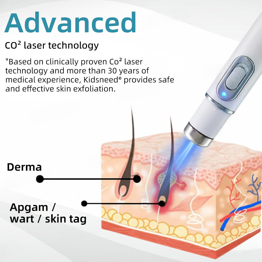 Remifa® Non-invasive Mole & Wart Removal Laser Pen(Quick and painless removal of warts, moles, age spots, and skin tags with no side effects)
