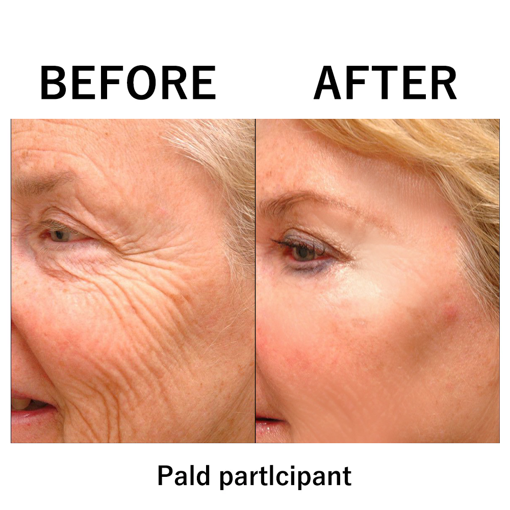 [Official Brand Store]🍁💖Furzero® Lift & Firm Instant Skin Tightener