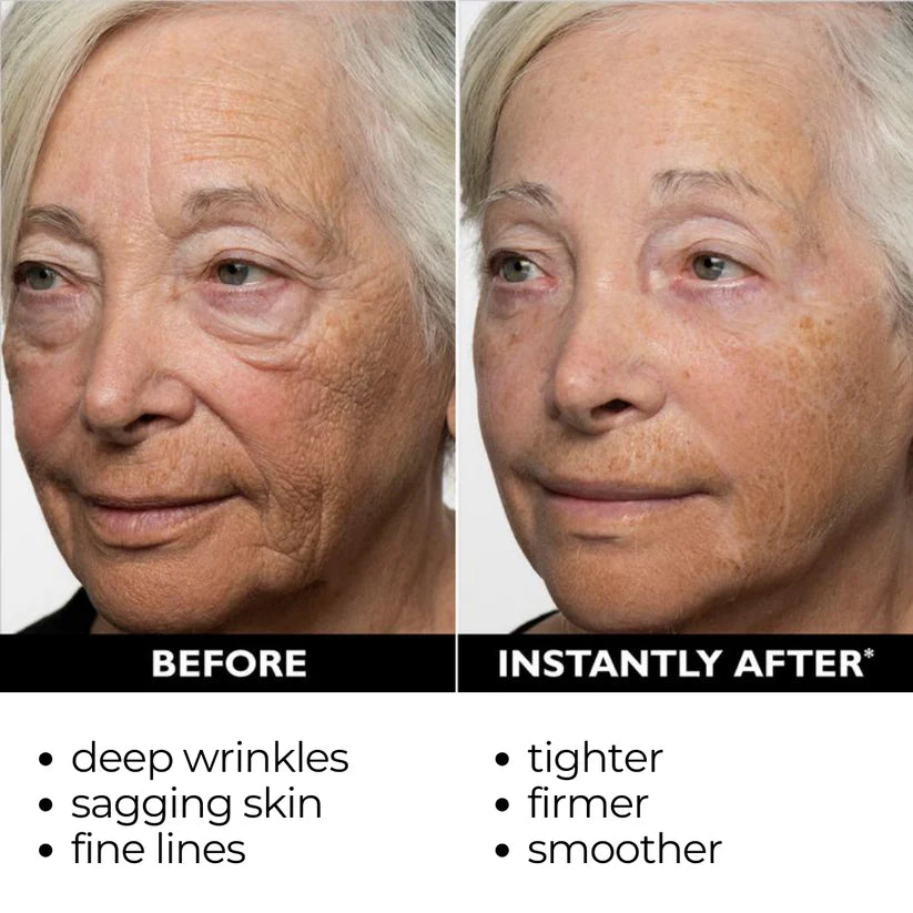 [Official Brand Store]🍁💖Furzero® Lift & Firm Instant Skin Tightener