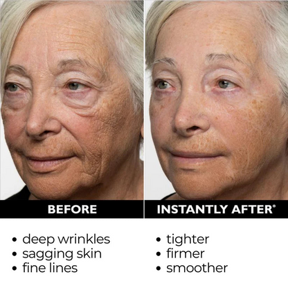 [Official Brand Store]🍁💖Furzero® Lift & Firm Instant Skin Tightener