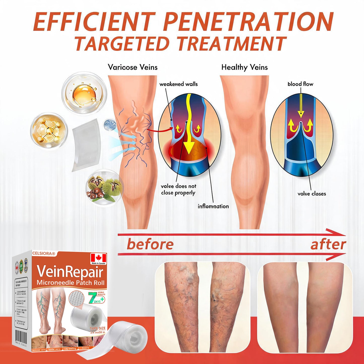 ☘️☘️Celsiora® Vein Ease Microneedle Care Patch(For Spider Veins, Varicose Veins, Swelling & Leg Fatigue) - Last Day Promotion 50% OFF