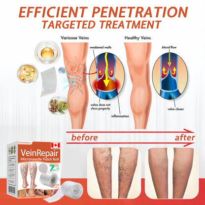 ☘️☘️Celsiora® Vein Ease Microneedle Care Patch(For Spider Veins, Varicose Veins, Swelling & Leg Fatigue) - Last Day Promotion 50% OFF