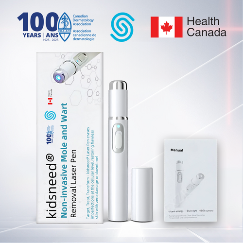 Remifa® Non-invasive Mole & Wart Removal Laser Pen(Quick and painless removal of warts, moles, age spots, and skin tags with no side effects)