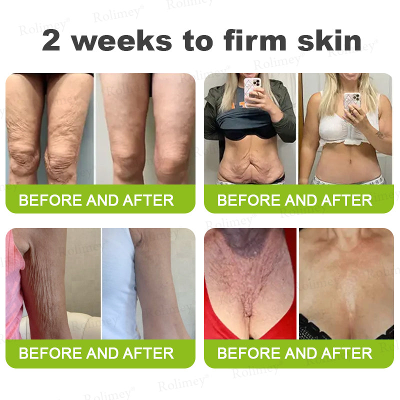 ✔Made and shipped from Canada 💫Rolimey® Botox & Vita-A Retinol Shot Wrinkle-Lift Tightening cream - Last Day Promotion 70% OFF
