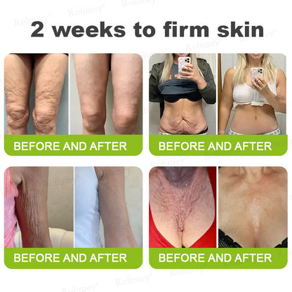 ✔Made and shipped from Canada 💫Rolimey® Botox & Vita-A Retinol Shot Wrinkle-Lift Tightening cream - Last Day Promotion 70% OFF