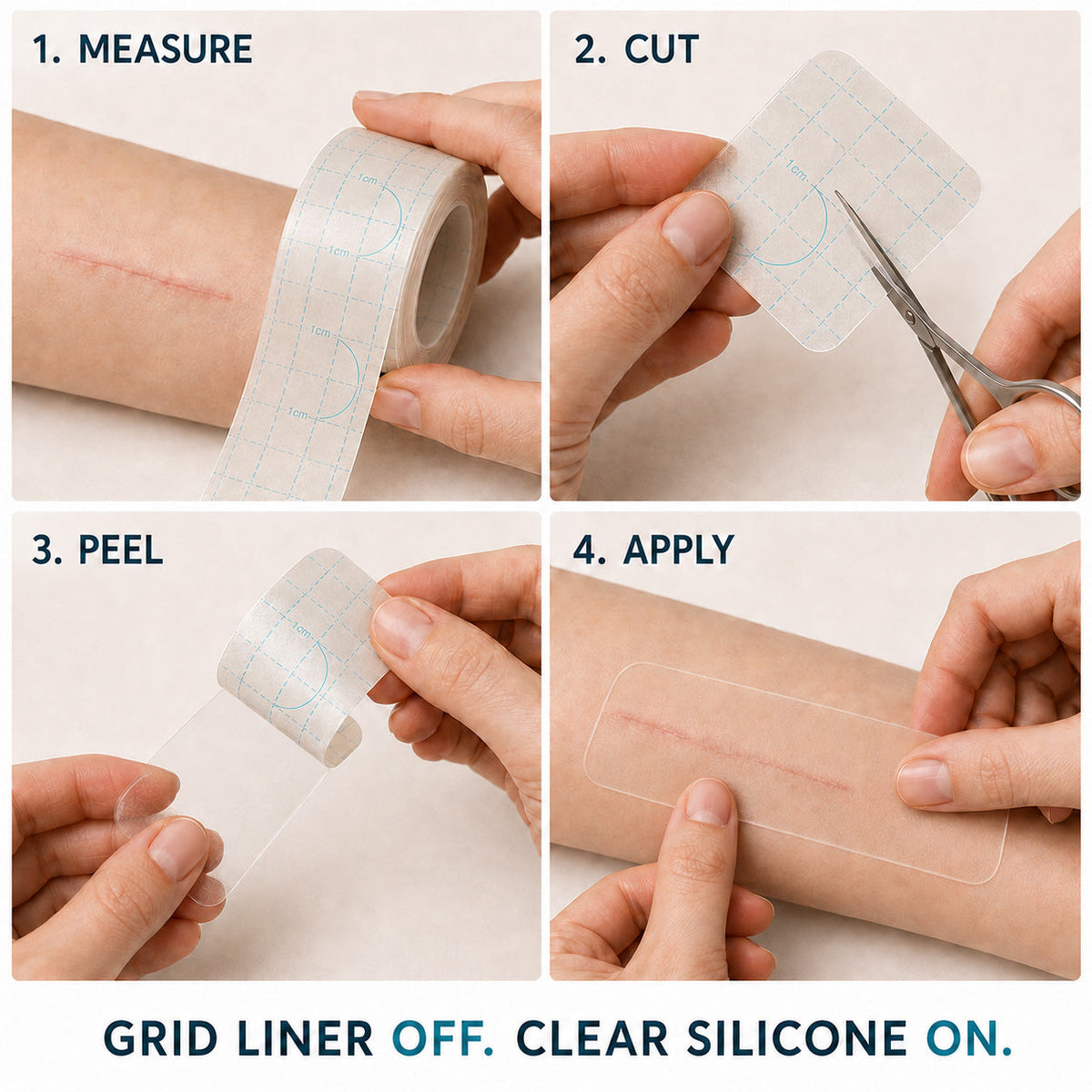 🍁TRILUMIA® SILICONE SCAR THERAPY ROLL  Help Soften, Flatten & Improve the Appearance of Raised Scars
