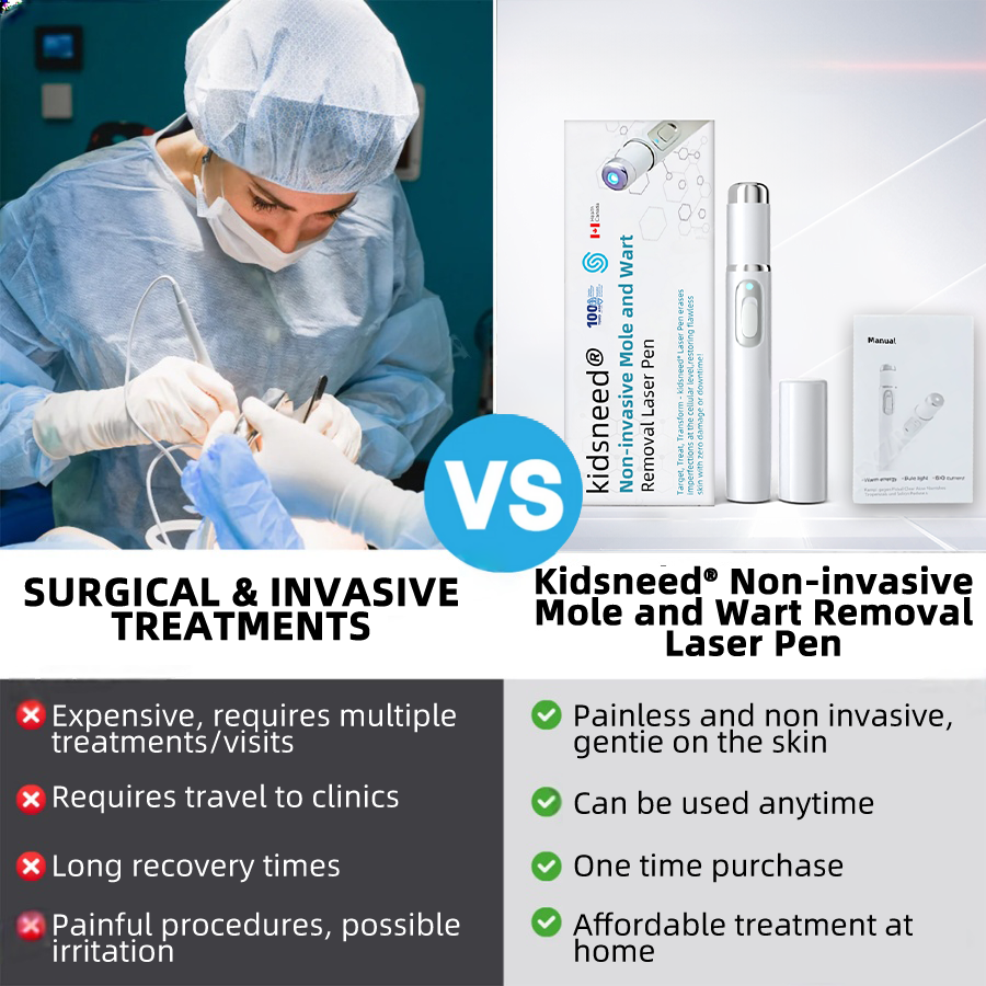 Remifa® Non-invasive Mole & Wart Removal Laser Pen(Quick and painless removal of warts, moles, age spots, and skin tags with no side effects)