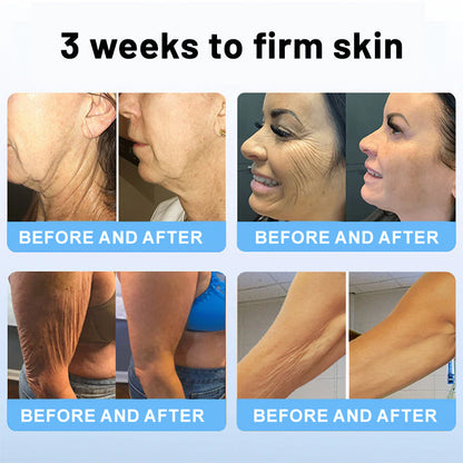 🍁🍊Flysmus™ Collagen Peptides FIRMING SERUM STICK