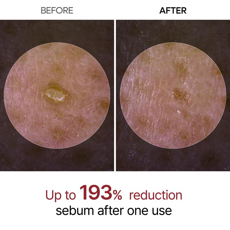 Serums for Brightening, Exfoliating
