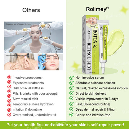 🍀Made and shipped from Canada 💫Rolimey® Botox & Vita-A Retinol Shot Wrinkle-Lift Tightening cream - Last Day Promotion 50% OFF
