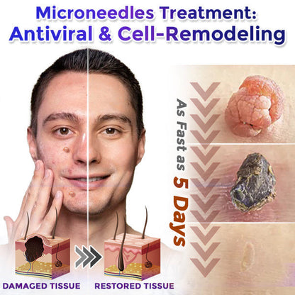 🍀💯Celsiora® Multi-Functional Microneedle Hydrocolloid Patch Roll | Targets Skin Tags, Warts & Stubborn Blemishes