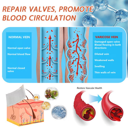 ☘️🎉Zvoevo® Vein Ease Microneedle Care Patch(For Spider Veins, Varicose Veins, Swelling & Leg Fatigue) - Last Day Promotion 50% OFF
