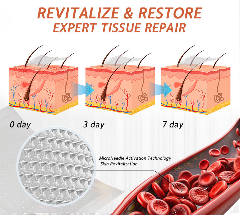 ☘️🎉Zvoevo® Vein Ease Microneedle Care Patch(For Spider Veins, Varicose Veins, Swelling & Leg Fatigue) - Last Day Promotion 50% OFF