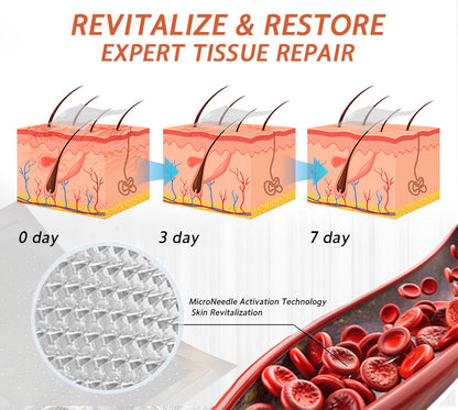 ☘️🎉Zvoevo® Vein Ease Microneedle Care Patch(For Spider Veins, Varicose Veins, Swelling & Leg Fatigue) - Last Day Promotion 50% OFF
