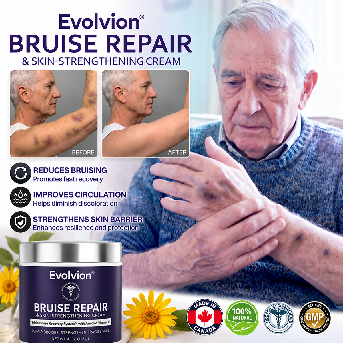 ✨✨Evolvion® Bruise Repair & Skin-Strengthening Cream-Advanced daily care for bruise-prone skin