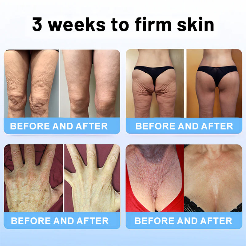 🍁🍊Flysmus™ Collagen Peptides FIRMING SERUM STICK