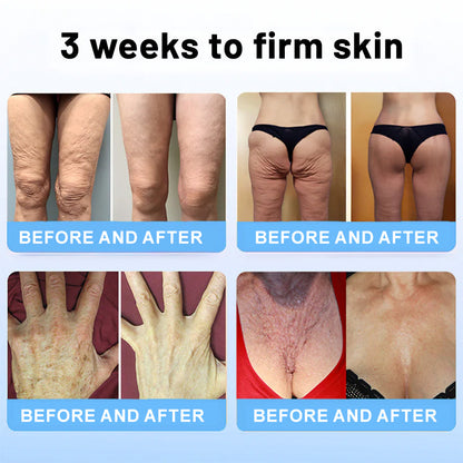 🍁🍊Flysmus™ Collagen Peptides FIRMING SERUM STICK