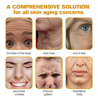 (🛰️Made and Shipped from Canada✅) 👩‍⚕️Furzero™ Botox Bee Venom Wrinkle Removal Cream-(LAST DAY 70% OFF)