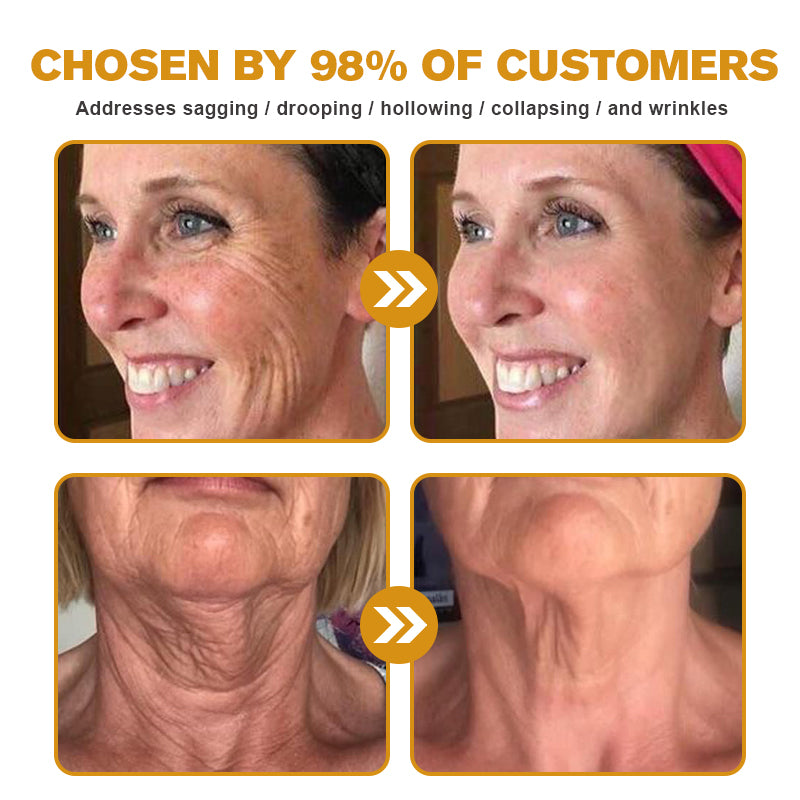 (🛰️Made and Shipped from Canada✅) 👩‍⚕️Furzero™ Botox Bee Venom Wrinkle Removal Cream-(LAST DAY 70% OFF)