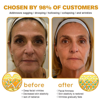 (🛰️Made and Shipped from Canada✅) 👩‍⚕️Furzero™ Botox Bee Venom Wrinkle Removal Cream-(LAST DAY 70% OFF)